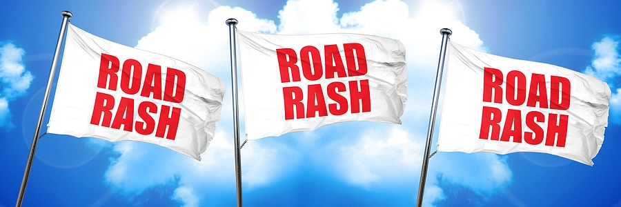 treat road rash